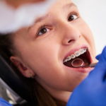 teeth braces treatment